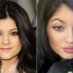 O real segredo dos lábios de Kylie Jenner